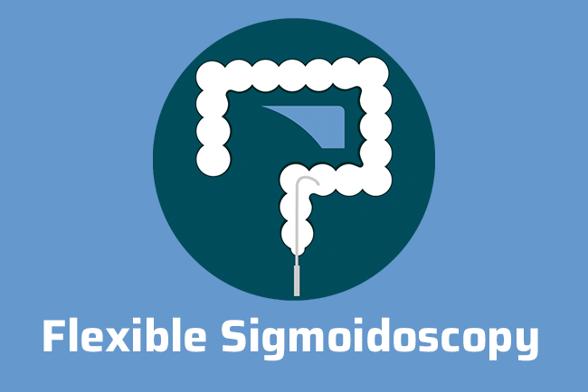 Flexible Sigmoidoscopy